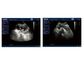 Scanner portatif d'ultrason de machine à la maison d'ultrason avec seulement le poids 4.5kgs