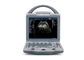 Scanner portatif d'ultrason de machine portative d'échocardiographie avec le moniteur réglable de 10,4 pouces