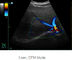 Scanner portatif ultrasonique d'ultrason de dispositif diagnostique d'Ipad avec le stockage de l'image 500G
