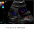 Scanner portatif d'ultrason d'équipement de balayage d'ultrason avec la fréquence 2. 0MHz~10. 0MHz de sonde