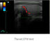 Scanner portatif d'ultrason d'équipement de balayage d'ultrason avec la fréquence 2. 0MHz~10. 0MHz de sonde