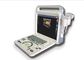 scanner portatif d'ultrason d'équipement de l'ultrason 4d avec la sonde à réseaux de dipoles de la fréquence centrale 3MHz
