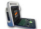 Scanner portatif d'ultrason de machine de représentation d'ultrason avec la capacité 160G