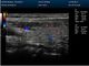 Couleur mobile Doppler de scanner portatif d'ultrason de Digital avec l'écran de 15 pouces LED
