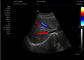 Équipement portatif d'ultrason du scanner 4d d'ultrason de machine médicale d'ultrason