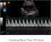 Colorez le scanner portatif d'ultrason de système d'ultrason de Doppler avec le moniteur de 12,1 pouces LED et 2 ports de sonde