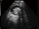 Petit poids léger de machine d'ultrason de plein de Digital scanner animal tenu dans la main d'ultrason