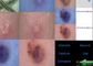 Détecteur de peau et de cuir chevelu Dermatoscope visuel avec le rapport d'Analysisi du colorant d'huile d'humidité flexible