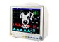 Équipement de surveillance patiente portatif de vétérinaire d'animaux de machine de moniteur patient d'animal familier de moniteur patient avec les accessoires animaux