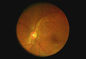 Pixels visuels disponibles de la résolution 1280 x 960 de fond d'ophthalmoscope de télémédecine tenue dans la main portative de caméra