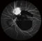 Caméra Confocal de fond d'Opthalmoscope Digital de rétine avec le champ de vision 15°, 30°, taille 1024*1024 de l'image 60°
