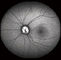 Caméra Confocal de fond d'Opthalmoscope Digital de rétine avec le champ de vision 15°, 30°, taille 1024*1024 de l'image 60°