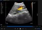L'ultrason sans fil sonde le dispositif tenu dans la main d'ultrason avec B, B/M, couleur Doppler, picowatt, éléments du mode 192 de Doppler de puissance