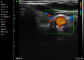 Application vasculaire abdominale de gynécologie de pédiatrie de Doppler d'ultrason d'Ipad de couleur portative tenue dans la main de scanner