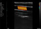 Fréquence de l'artère carotide 7.5-10MHz de balayages d'Echo Handheld Color Doppler Linear