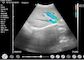 Application obstétrique de pédiatrie de gynécologie de Doppler d'ultrason d'ultrason tenu dans la main diagnostique portatif à la maison de Doppler