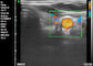 Application obstétrique de pédiatrie de gynécologie de Doppler d'ultrason d'ultrason tenu dans la main diagnostique portatif à la maison de Doppler