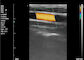 Ultrason portatif de scanner à la maison d'ultrason de machine d'ultrason de couleur pour la grossesse 8 TGC 3.5~10 mégahertz