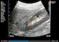 Scanner tenu dans la main d'ultrason d'ultrason de poche avec B, B/M, couleur Doppler, picowatt, éléments du mode 128 de Doppler de puissance