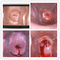 Colposcope électronique de Digital d'appareil-photo vaginal pour trouver la maladie du cervix Eealier