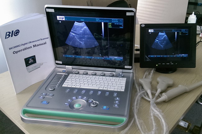 ordinateur portable B de 3D Digital/scanner portatif ultrason de W avec les sondes Transvaginal linéaires convexes