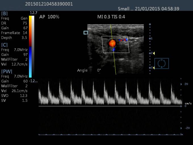 15 dispositif diagnostique portatif d'ultrason de machine de Dopple de couleur d'ultrason d'affichage à cristaux liquides 2D de contact de pouce
