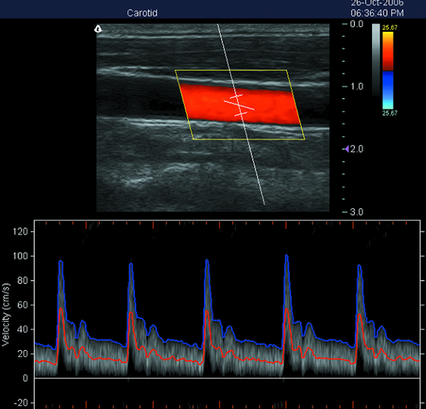 Scanner portatif d'ultrason de Doppler de couleur de machine de l'ultrason 3D avec l'écran de 15 pouces LED