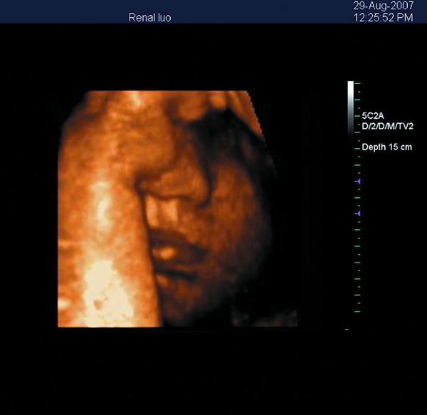 Scanner portatif d'ultrason de Doppler de couleur de machine de l'ultrason 3D avec l'écran de 15 pouces LED