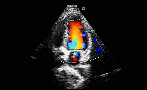 Scanner médical d'ultrason de Doppler de couleur de machine de balayage d'ultrason avec le transducteur cardiaque