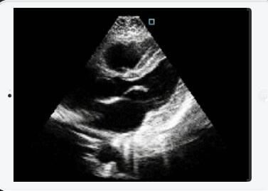 Scanner médical d'ultrason de Doppler de couleur de machine de balayage d'ultrason avec le transducteur cardiaque