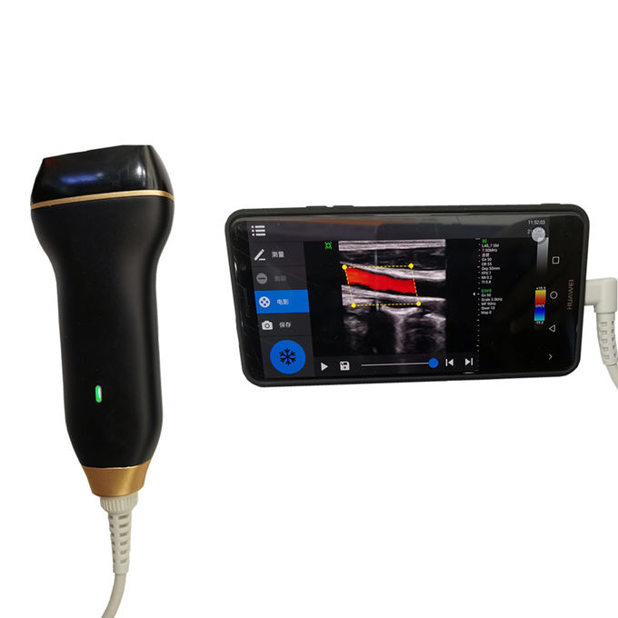 Scanner à la maison d'ultrason de Doppler de couleur de machine de représentation d'ultrason avec la connexion d'USB