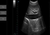 Machine portative d'ultrason d'Ipad de paume de scanner d'ultrason d'équipement de balayage d'ultrason