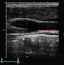 Scanner portatif d'ultrason de Devics d'ultrason tenu dans la main avec l'écran à hauteur de résolution de 10,4 pouces