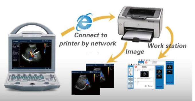 Machine portative de Doppler de couleur de scanner d'ultrason de couleur de Digital BIO 5000C avec l'écran d'affichage à cristaux liquides de 10,4 pouces