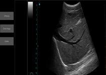 Machine portative d'ultrason d'Ipad de paume de scanner d'ultrason d'équipement de balayage d'ultrason