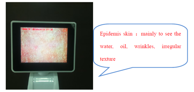 Mètre d'humidité de peau de Digital d'analyseur de peau de la CE BS5SH Digital pour le docteur