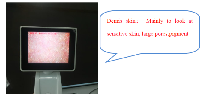 Mètre d'humidité de peau de Digital d'analyseur de peau de la CE BS5SH Digital pour le docteur