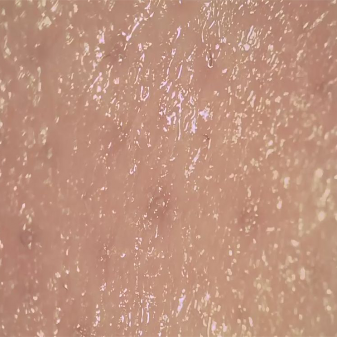 Analyseur sans fil de peau de Digital de détecteur d'humidité de peau pour observer la surface des pores de Derm de peau
