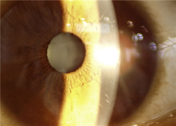 Lampe fendue portative de dispositif d'ophthalmologie d'application de télémédecine avec la largeur fendue 0-12mm sans interruption réglables