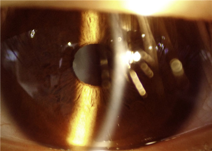 Équipement fendu tenu dans la main d'ophthalmologie de lampe de Digital utilisé pour le rapport optique antérieur 16MP Resolution de la représentation 10X de segment