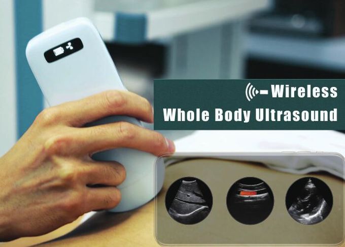 le chargeur sans fil intégré de batterie au lithium 4200mAh d'ultrason de 5G Wifi de scanner d'ultrason tenu dans la main de poche a soutenu 1