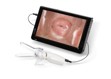Mini Colposcope pour la caméra vaginale cervicale d'Examintion reliée à la TV ou au PC