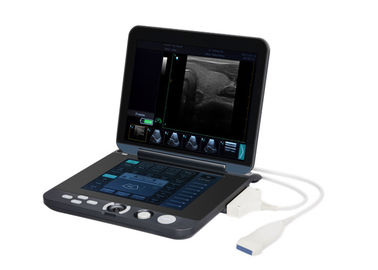Scanner portatif d'ultrason de Digital de mémoire permanente de 128 images avec l'écran de 12 pouces LED