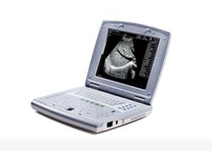 Scanner portatif d'ultrason de bébé de machine portative d'ultrason pour la pédiatrie
