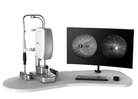 Otoscope visuel de Digital de portée de mini ophthalmoscope médical d'otoscope avec USB/poids du commerce de production