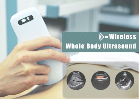 scanner électronique d'ultrason de Digital de la rangée 3.6Mhz pour l'abdomen cardiaque