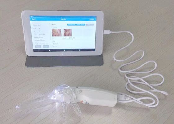 Colposcope visuel de Digital pour le soin de femme appareil-photo professionnel de moniteur médical de 10 ou 7 pouces pour l'inspection du cervix