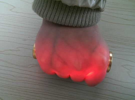 Détecteur de veines infrarouges