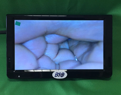 Colposcope électronique numérique portable