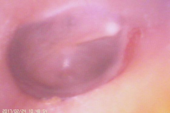 Otoscope vidéo numérique 720X480